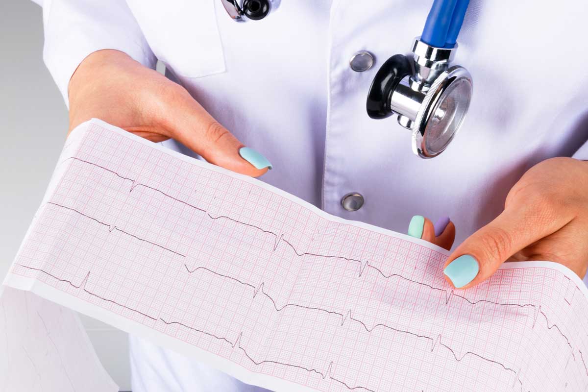 Ecg In Hand Of A Female Doctor