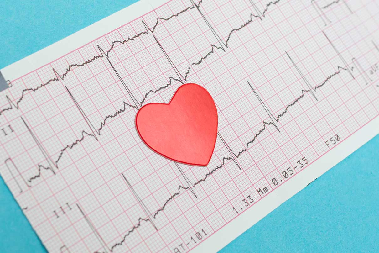 Electrocardiography Ecg. Heart Lies On The Cardiogram