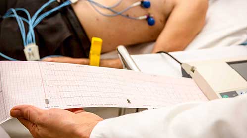 The Cardiologist Holding And Review The Electrocardiograph Ekg Or Ecg Diagram Printed On Grid Paper